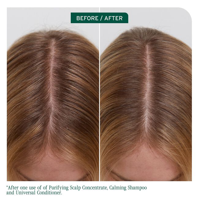Scalp Sync Purifying Concentrate