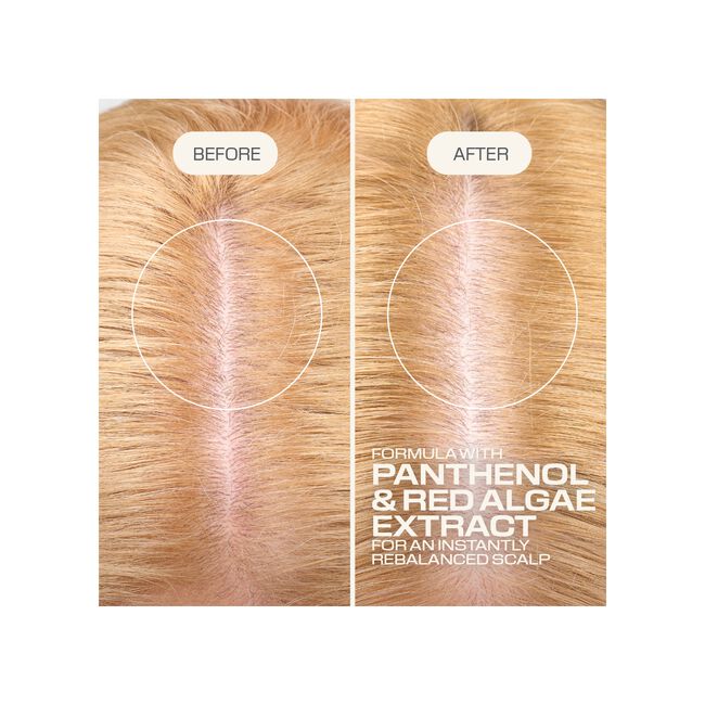 Dualsenses Scalp Specialist Rebalance & Hydrate Fluid