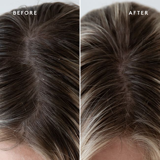 Exfoliating Scalp Treatment
