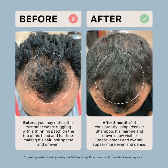 Recover Thickening Shampoo Treatment for Men