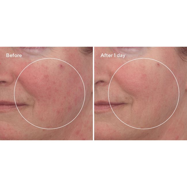 Cellular Hydration Repair Mask