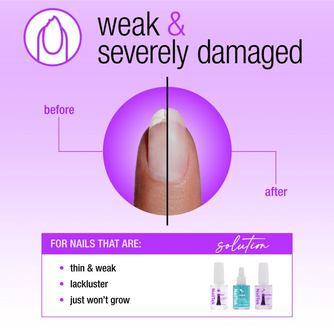 Nail Rescue System Kit