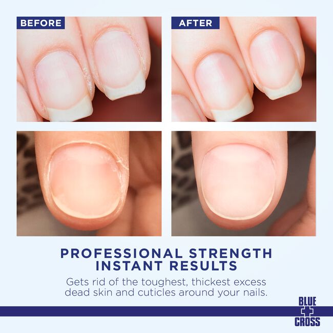 Cuticle Remover Cream