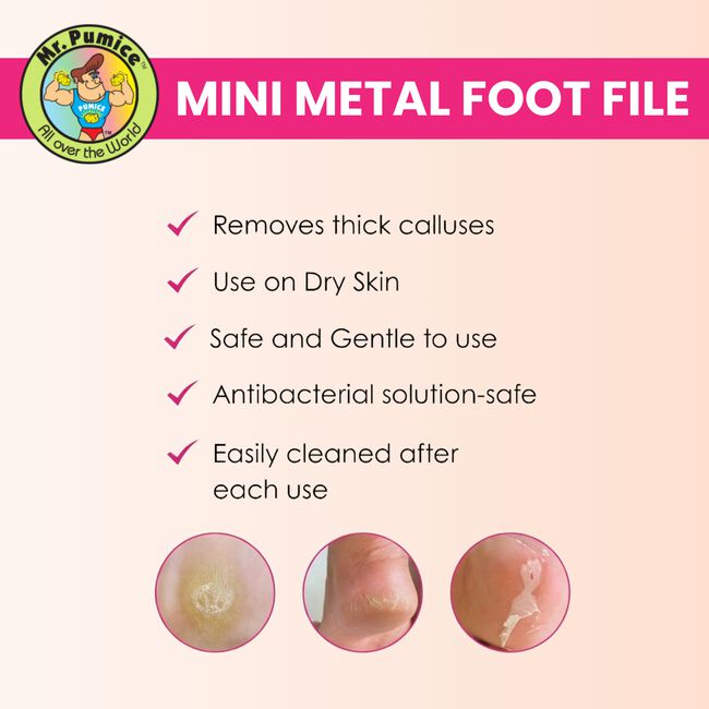 Mini Metal Foot File