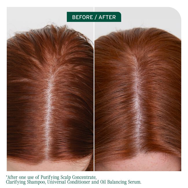 Scalp Sync Clarifying Shampoo for Oily Scap