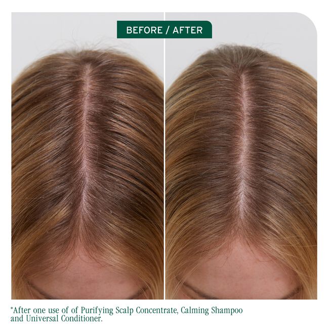 Scalp Sync Calming Shampoo for Dry Sensitive Scalp