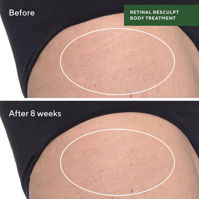 Retinal Resculpt Body Treatment