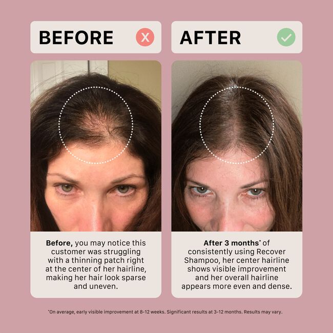 Recover Thickening Shampoo Treatment for Women