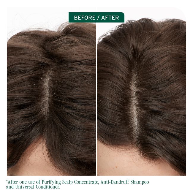 Scalp Sync Pyrithione Zinc Antidandruff Shampoo
