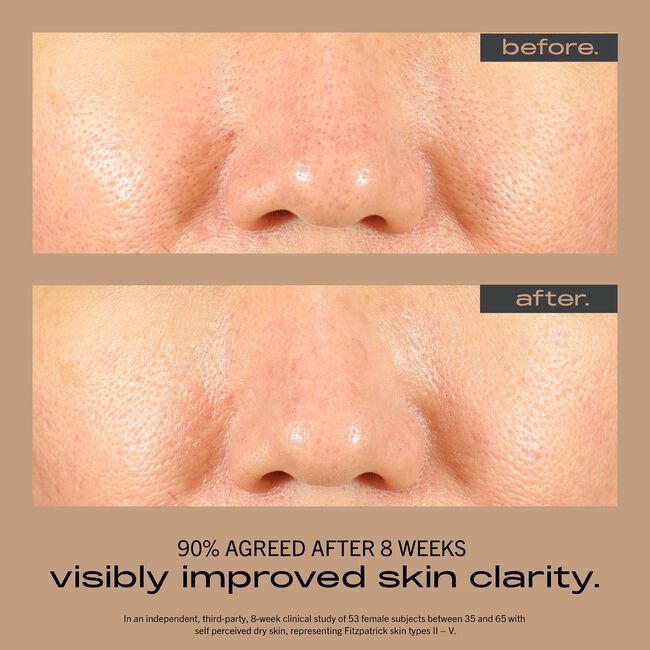Resurfacing + Hydrating Serum