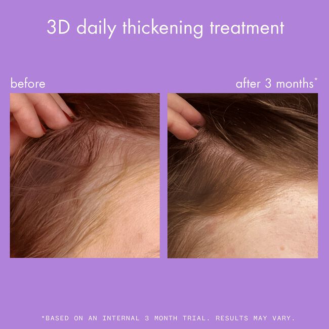 3D Daily Thickening Treatment