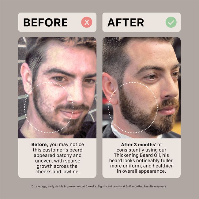 Recover Men's Trio Kit