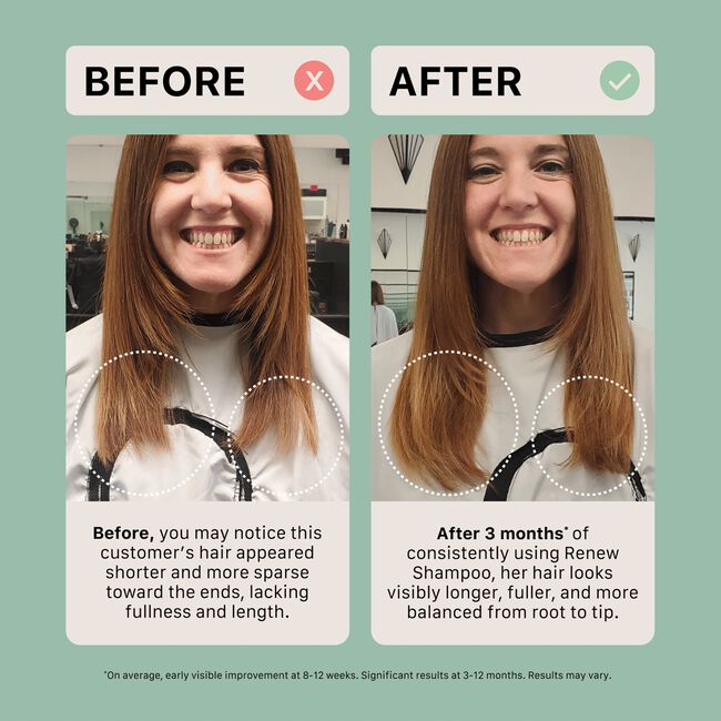 Renew Shampoo & Conditioning System