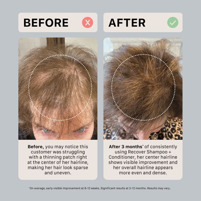 Remedy Dandruff Trio Kit