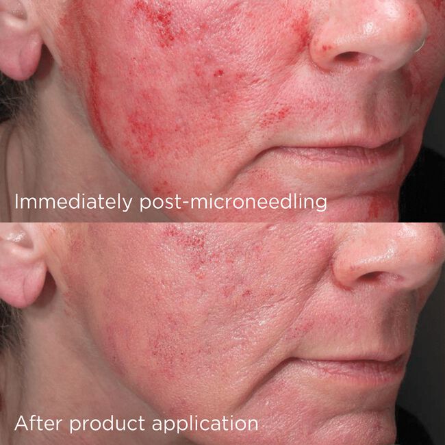 Daily Prevention Advanced Smartblend Mineral Moisturizer SPF 75