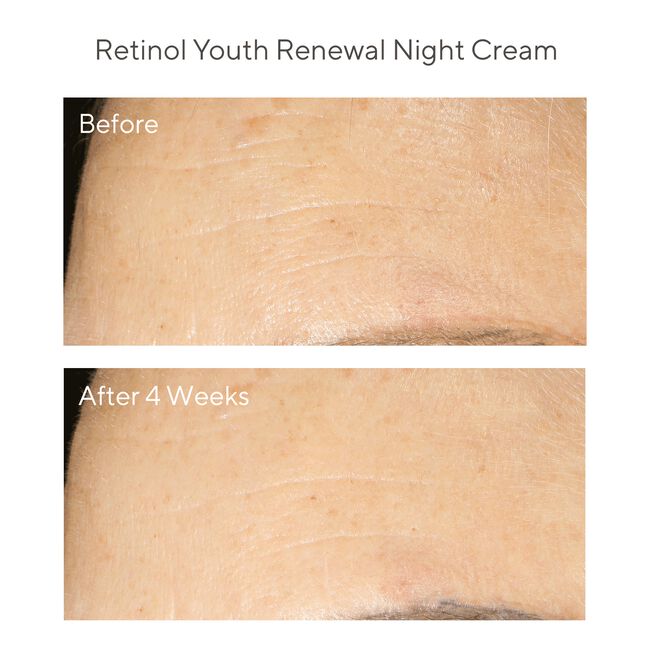 Retinol Youth Renewal Night Cream
