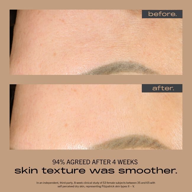Resurfacing + Hydrating Serum