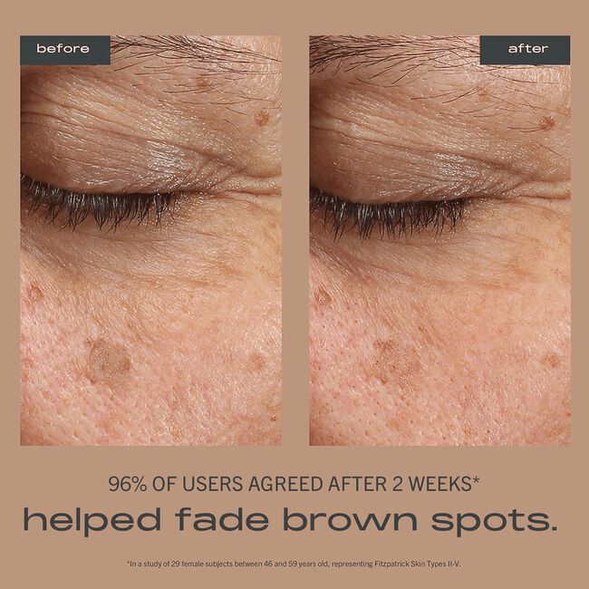 Brightening + Firming Vitamin C Serum