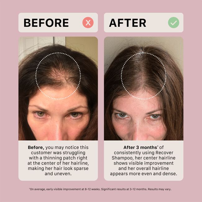 Recover Thickening Shampoo Treatment for Women