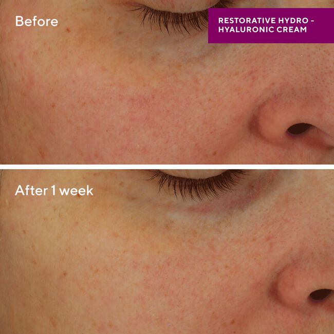 Restorative Hydro Hyaluronic Moisture Cream