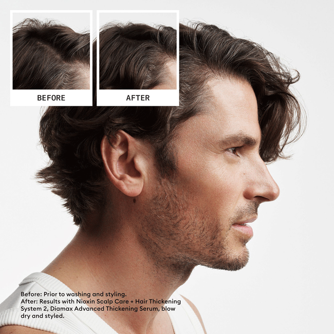 System Kit 2 Nioxin Cosmoprof