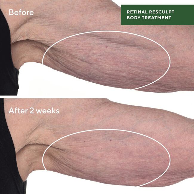 Retinal Resculpt Body Treatment
